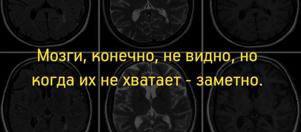мозги.jpg